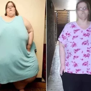 World’s Heaviest Woman Drops Jaw-Dropping 763 Pounds